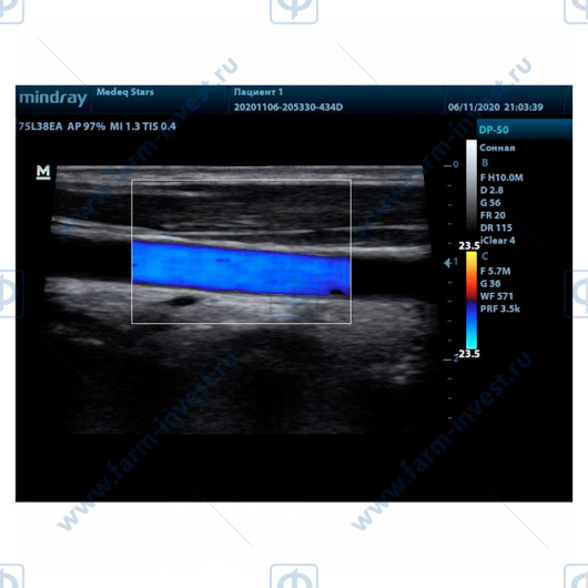 Аппарат УЗИ Mindray DP-50 Color портативный