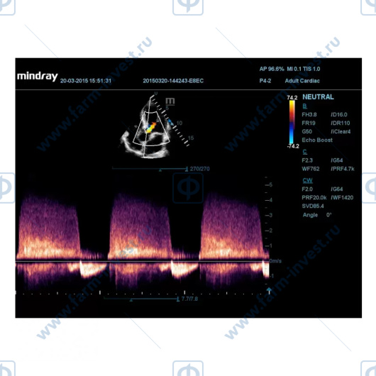 Аппарат УЗИ Mindray DС-60 Pro X-Insight стационарный