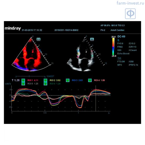 Аппарат УЗИ Mindray DС-60 Pro X-Insight стационарный