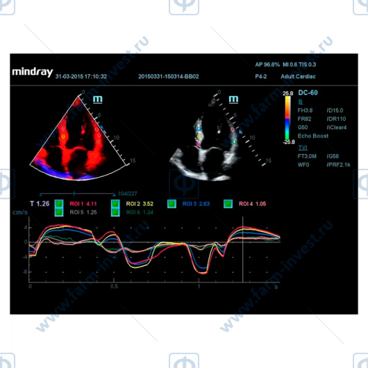 Аппарат УЗИ Mindray DС-60 Pro X-Insight стационарный