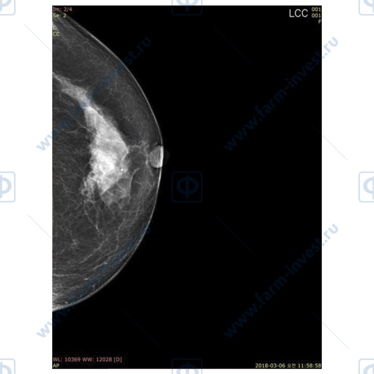 Маммографическая цифровая система DМХ-600