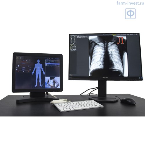 Аппарат флюорографический цифровой РЕНЕКС Ф-5000