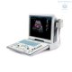 Аппарат УЗИ Mindray DP-50 Color портативный - Изображение 0