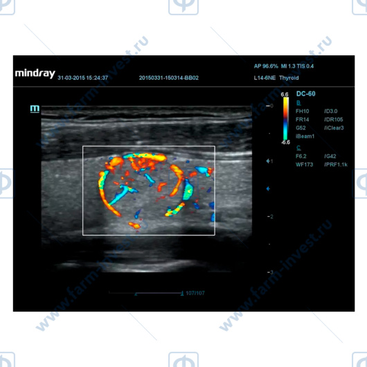 Аппарат УЗИ Mindray DС-60 Pro X-Insight стационарный