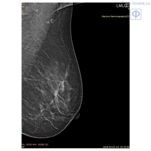 Маммографическая цифровая система DМХ-600