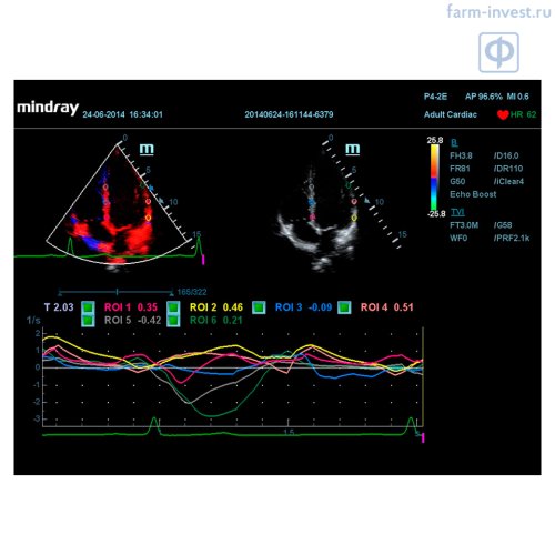 Аппарат УЗИ Mindray DC-70 Pro X-insight стационарный Аппарат УЗИ Mindray DC-70 Pro X-insight стационарный