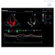 Аппарат УЗИ Mindray DC-70 Pro X-insight стационарный - Изображение 5 Аппарат УЗИ Mindray DC-70 Pro X-insight стационарный - Изображение 5