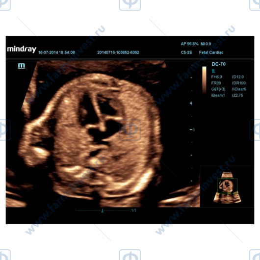 Аппарат УЗИ Mindray DC-70 Pro X-insight стационарный