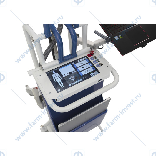 Аппарат для рентгенографии передвижной палатный РЕНЕКС