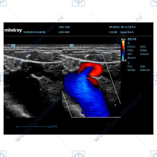 Аппарат УЗИ Mindray DC-70 Pro X-insight стационарный