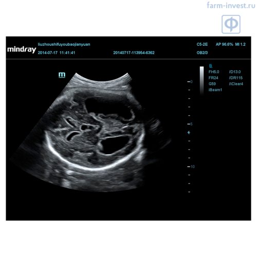 Аппарат УЗИ Mindray DC-70 Pro X-insight стационарный Аппарат УЗИ Mindray DC-70 Pro X-insight стационарный