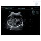 Аппарат УЗИ Mindray DC-70 Pro X-insight стационарный - Изображение 8 Аппарат УЗИ Mindray DC-70 Pro X-insight стационарный - Изображение 8