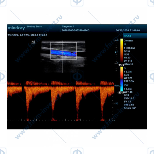 Аппарат УЗИ Mindray DP-50 Color портативный