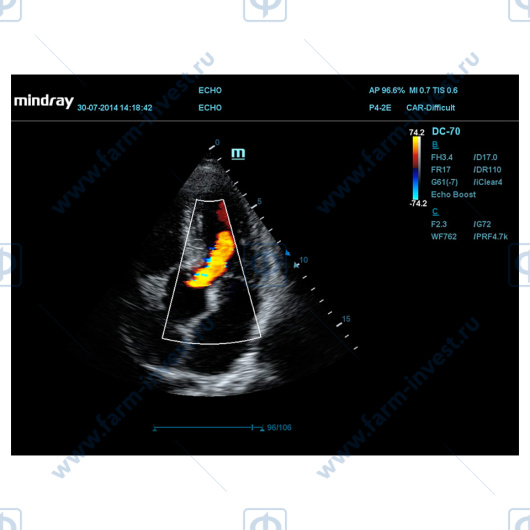 Аппарат УЗИ Mindray DC-70 Pro X-insight стационарный